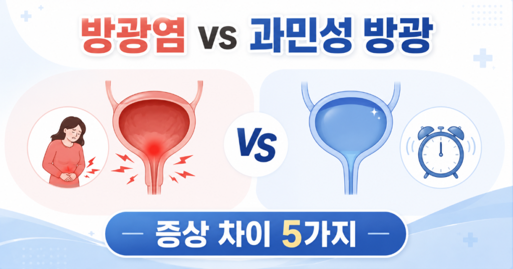 방광염과 과민성 방광 차이를 증상별로 비교한 건강 정보 썸네일