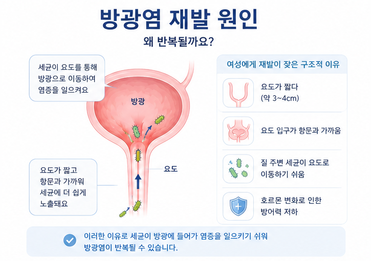 세균이 요도를 통해 방광으로 들어가 방광염 재발이 생길 수 있음을 설명한 인포그래픽